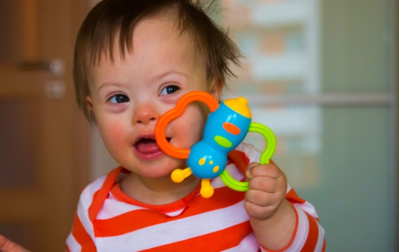 No hay todavía tratamientos para el Síndrome de Down, tan solo propuestas experimentales